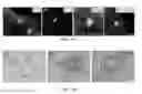 Fig. 08 - IN VITRO 3D CULTURE OF HUMAN BRAIN TISSUE