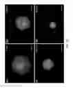 Fig. 14 - Enrichment and detection of nucleic acids with ultra-high sensitivity