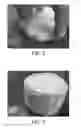 Fig. 05 - Deployable gridded ion thruster
