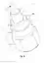 Fig. 02 - Compact bearing assemblies including superhard bearing surfaces, bearing apparatuses, and methods of use