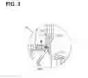 Fig. 04 - Cooling device for additive injection valve