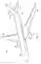Fig. 02 - Pressure sleeve