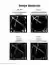 Fig. 08 - Imaging system and method for use in surgical and interventional medical procedures