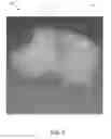 Fig. 06 - Methods, apparatuses, and systems for creating 3-dimensional representations exhibiting geometric and surface characteristics of brain lesions
