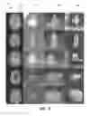 Fig. 08 - Methods, apparatuses, and systems for creating 3-dimensional representations exhibiting geometric and surface characteristics of brain lesions