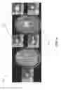Fig. 10 - Methods, apparatuses, and systems for creating 3-dimensional representations exhibiting geometric and surface characteristics of brain lesions