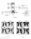 Fig. 03 - Generative adversarial network medical image generation for training of a classifier