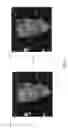 Fig. 02 - Automatic image correction using machine learning