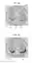 Fig. 12 - Similar case image search program, similar case image search apparatus, and similar case image search method