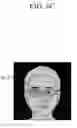 Fig. 09 - Apparatus and method for detecting reflection