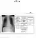 Fig. 05 - Dynamic image processing method and dynamic image processing device