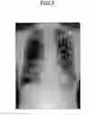 Fig. 06 - Dynamic image processing method and dynamic image processing device