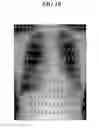 Fig. 09 - Dynamic image processing method and dynamic image processing device