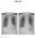 Fig. 17 - Dynamic image processing method and dynamic image processing device