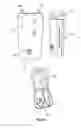 Fig. 18 - Technologies for initial provisioning and refilling of medical devices
