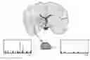 Fig. 01 - Mass spectrometric determination of particular tissue states
