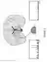 Fig. 04 - Mass spectrometric determination of particular tissue states
