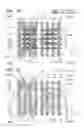 Fig. 15 - Semiconductor device