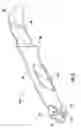 Fig. 04 - Knife accessory for hot stick