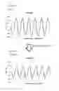Fig. 16 - STATOR, AND MOTOR COMPRISING SAME