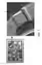 Fig. 02 - Resonator package and method of manufacturing the same