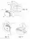 Fig. 05 - Earpiece with stabilizing features and related technology