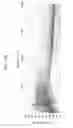Fig. 09 - Directional microphone