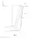 Fig. 18 - COMBINE HARVESTER CONCAVE THRESHING BARS