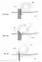 Fig. 26 - COMBINE HARVESTER CONCAVE THRESHING BARS