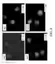 Fig. 08 - Platelet Additive Solution Having a Beta-Galactosidase Inhibitor