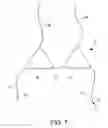 Fig. 07 - Convertible bikini top and apparatus for conversion of a bikini top