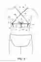 Fig. 08 - Convertible bikini top and apparatus for conversion of a bikini top