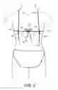 Fig. 09 - Convertible bikini top and apparatus for conversion of a bikini top