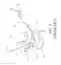 Fig. 04 - Intracorporeal transillumination of tissue using LED array