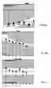 Fig. 07 - Ocular-performance-based head impact measurement using a faceguard