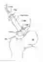 Fig. 01 - Methods and devices for accessing and retracting a capsule of a joint