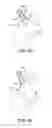 Fig. 06 - Methods and devices for accessing and retracting a capsule of a joint