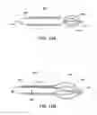Fig. 22 - Methods and devices for accessing and retracting a capsule of a joint