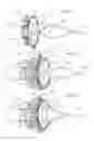 Fig. 04 - Trans-septal closure and port device