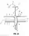 Fig. 06 - Surgical port closure system