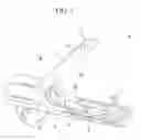 Fig. 02 - Medical stapler system