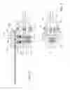 Fig. 04 - Surgical blade assembly including a static guide bar and an oscillating blade