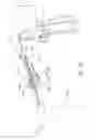 Fig. 09 - Surgical blade assembly including a static guide bar and an oscillating blade