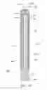 Fig. 14 - Surgical blade assembly including a static guide bar and an oscillating blade