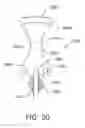 Fig. 20 - Surgical blade assembly including a static guide bar and an oscillating blade