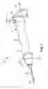 Fig. 02 - Osteotome