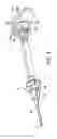 Fig. 04 - Osteotome