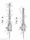 Fig. 02 - System for removing a clot from a blood vessel