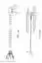 Fig. 03 - Medical device to remove an obstruction from a body lumen, vessel or organ