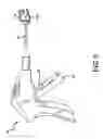 Fig. 07 - Medical device to remove an obstruction from a body lumen, vessel or organ